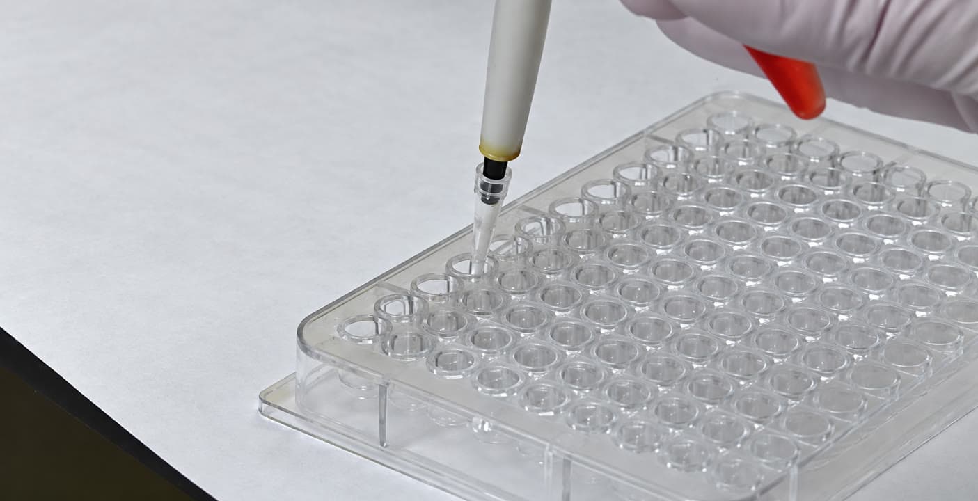 L’AFAM clama per a l’aprovació dels nous medicaments contra l’Alzheimer